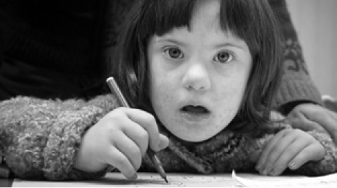down syndrome child